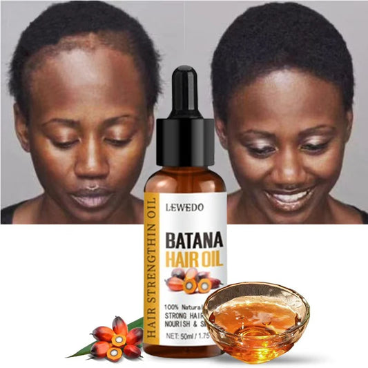 Huile naturelle Batana Lewedo Naturals,